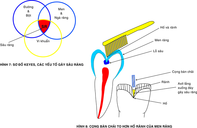 nguyen-nhan-gay-sau-rang-01