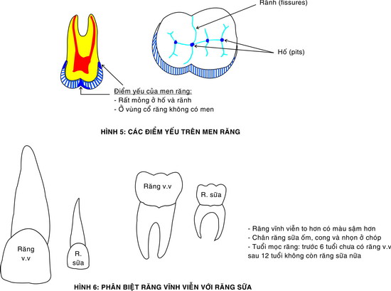 phan-biet-rang-vinh-vien-voi-rang-sua