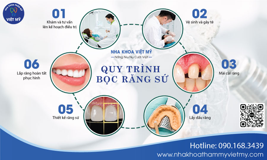 Răng sứ thẩm mỹ 4 quy-trinh-boc-rang-su-chuan-y-khoa-nha-khoa-viet-my